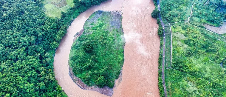 Alzheimer Demans Farkı
